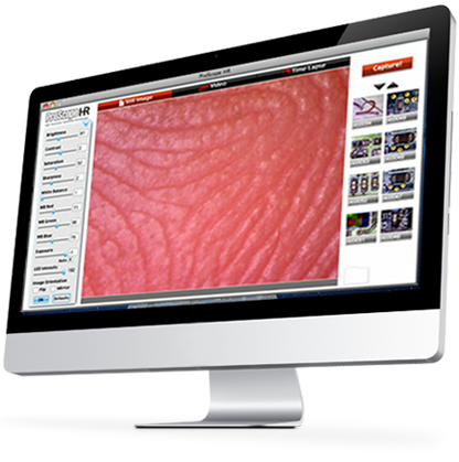 1000x usb digital microscope software